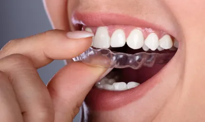 Why Should You Choose Invisalign Over Online Clear Aligners?-photo