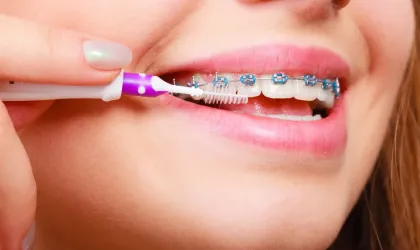 5 Tips for Caring for Your Braces-photo