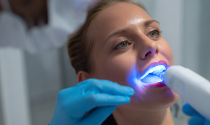 The Invisalign Fitting Process Explained-photo