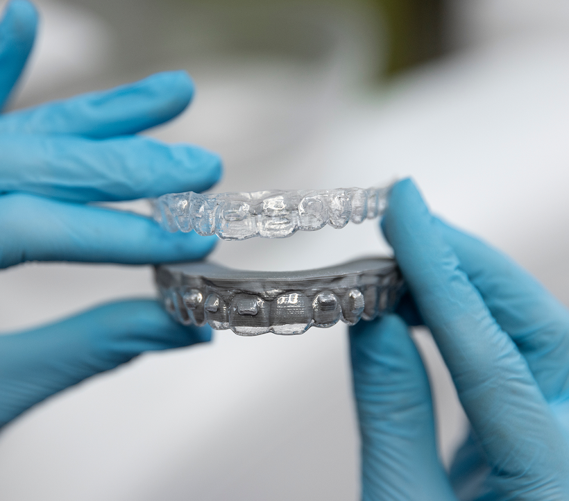 Clear Aligners